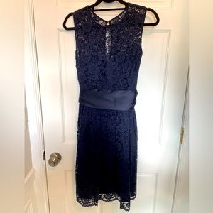 Tevolio Lace Dress